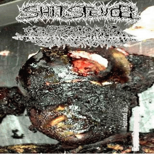 Trabecular Hepatocellular Carcinoma : ShitStench - Trabecular Hepatocellular Carcinoma